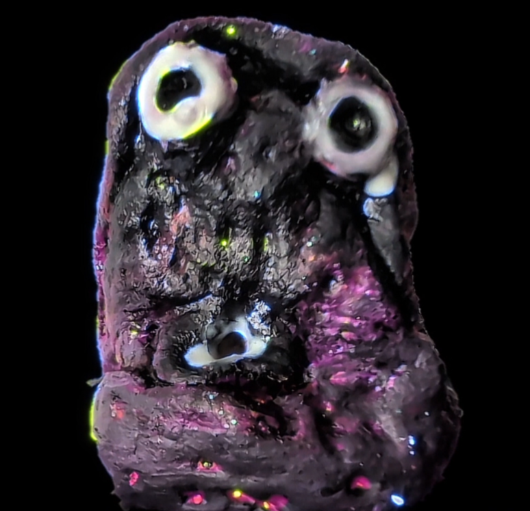 ANXiETY GLOB